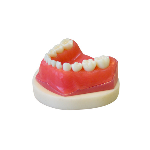 Денто-модель для хирургической практики