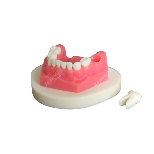 Денто-модель с патологиями ЧВН-24П