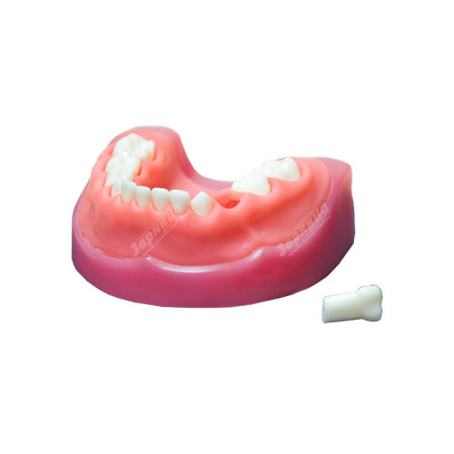 Денто-модель детской верхней и нижней челюсти ЧВН-24 N