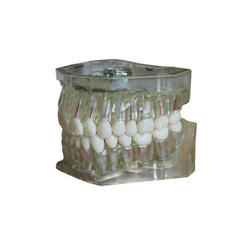 Денто-модель верхней и нижней челюстей для эндодонтии ЧВН-32Э