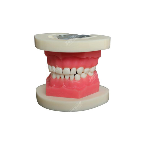 Денто-модель с патологиями ЧВН-24П