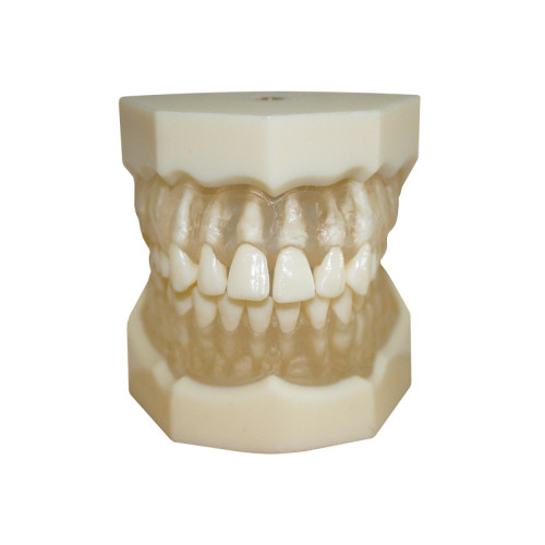 Денто-модель верхней и нижней челюстей с прозрачными деснами для удаления ЧВН-28УП