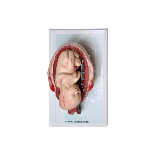 Комплект демонстрационных моделей этапов эмбриогенеза человека