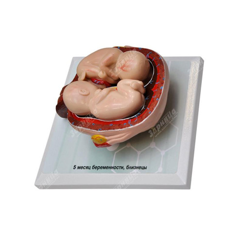 Комплект демонстрационных моделей этапов эмбриогенеза человека